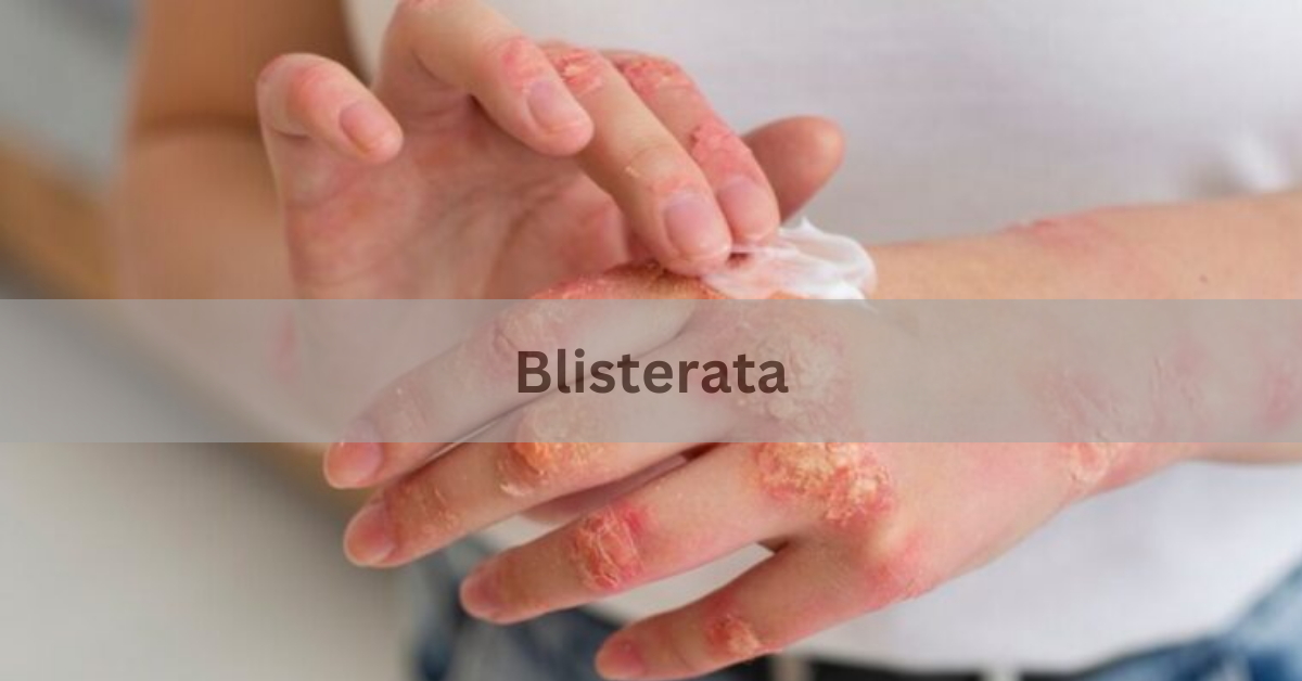 Blisterata